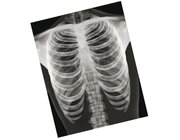 R�ntgenbilder - Mensch, 18 Detailaufnahmen, ab 6 Jahre