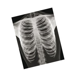 R�ntgenbilder - Mensch, 18 Detailaufnahmen, ab 6 Jahre